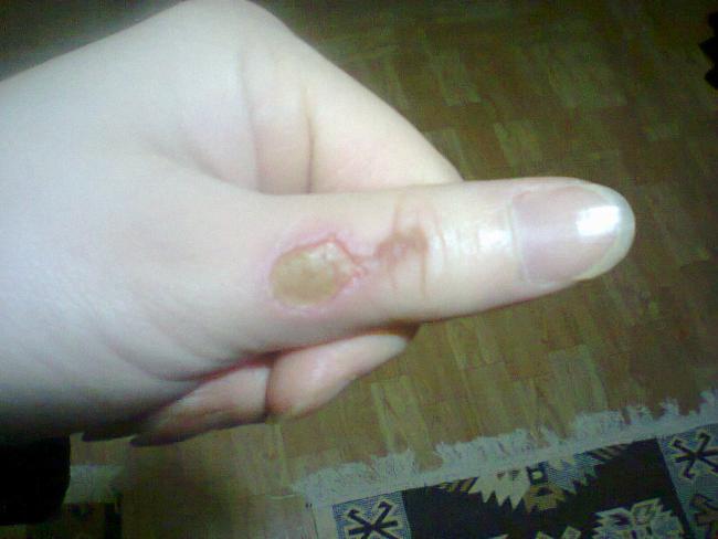 Name:  Yank yaram.jpg
Views: 7219
Size:  31.6 KB
