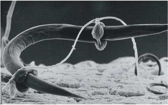 Name:  Namatode_Trapping_By_Fungi.jpg
Views: 6401
Size:  35.8 KB