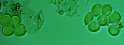 Name:  choleralla.jpg
Views: 6585
Size:  10.9 KB